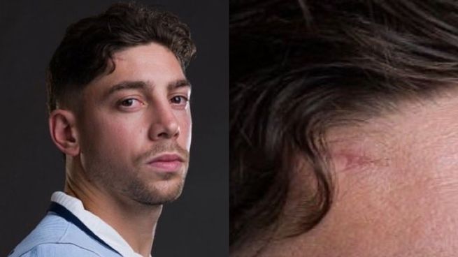 La cicatriz de Federico Valverde en la foto oficial de Uruguay para el Mundial que llamó la atención de los hinchas