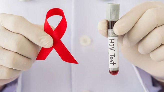 El SIDA es una complicación de la enfermedad conocida como Virus de la Inmunodeficiencia Humana.