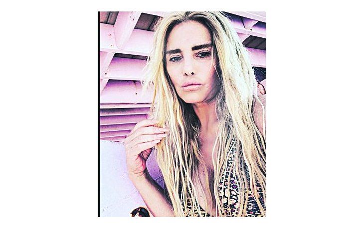 Silvia Rodríguez. Vivía en Miami, pero viajó especialmente a Colombia para realizarse la liposucción.