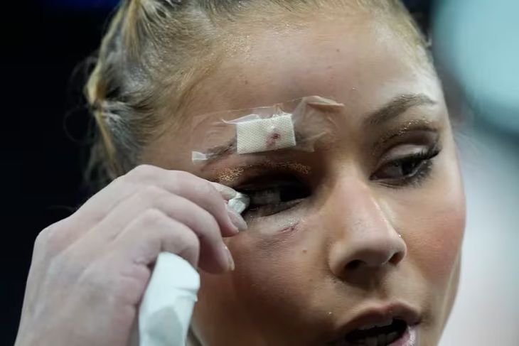 Despite the injury, Saraiva was able to obtain the bronze medal. Despite the injury, Saraiva was able to obtain the bronze medal.