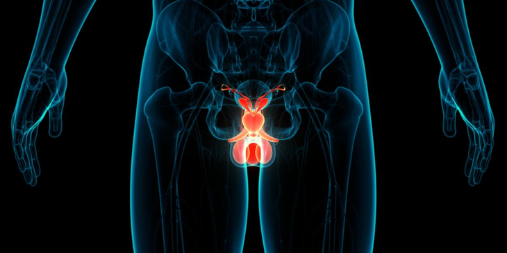 Cáncer de próstata