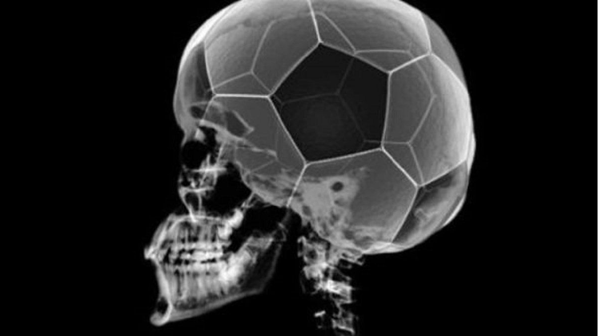 Brain: how it works in the face of a sports defeat