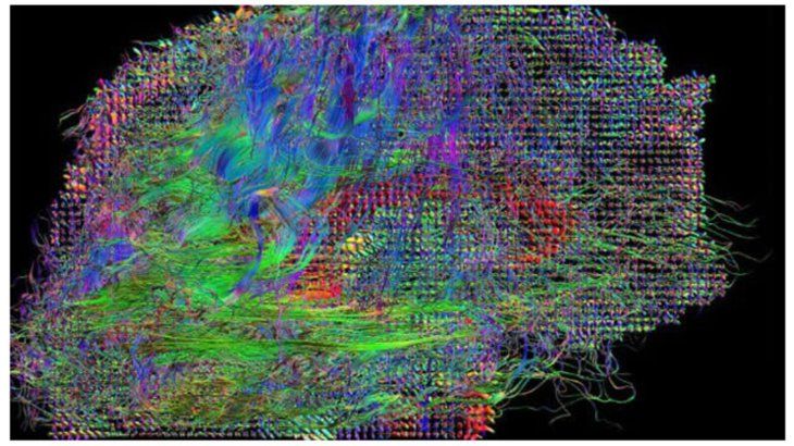 A recent analysis that gathered 24 experimental studies evaluated the impact of the reproduction speed on understanding. A recent analysis that gathered 24 experimental studies evaluated the impact of the reproduction speed on understanding.
