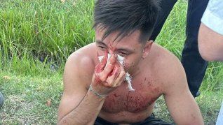 Mateo di Bari sufrió graves lesiones tras un ataque de rugbiers.