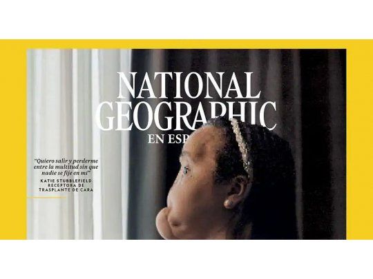 La trasplantada de cara más joven de EEUU es tapa de National Geographic