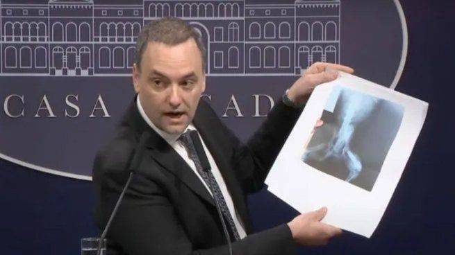 Manuel Adorni, cuando confundió la radiografia de un perro con la de una personal. El vocero suspendió las conferencias de prensa y es un activo tóxico de La Libertad Avanza.