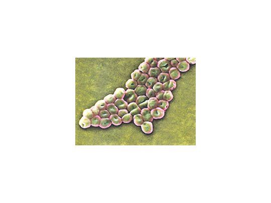 La bacteria A.Baumannii vistaen un microscopioelectrónico.Ataca en Irak yAfganistán y hadesarrolladoresistencia atodos losmedicamentos.