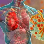 De los más de 8.000 pacientes participantes, más de 4.300 recibieron el nuevo protocolo. De los más de 8.000 pacientes participantes, más de 4.300 recibieron el nuevo protocolo.