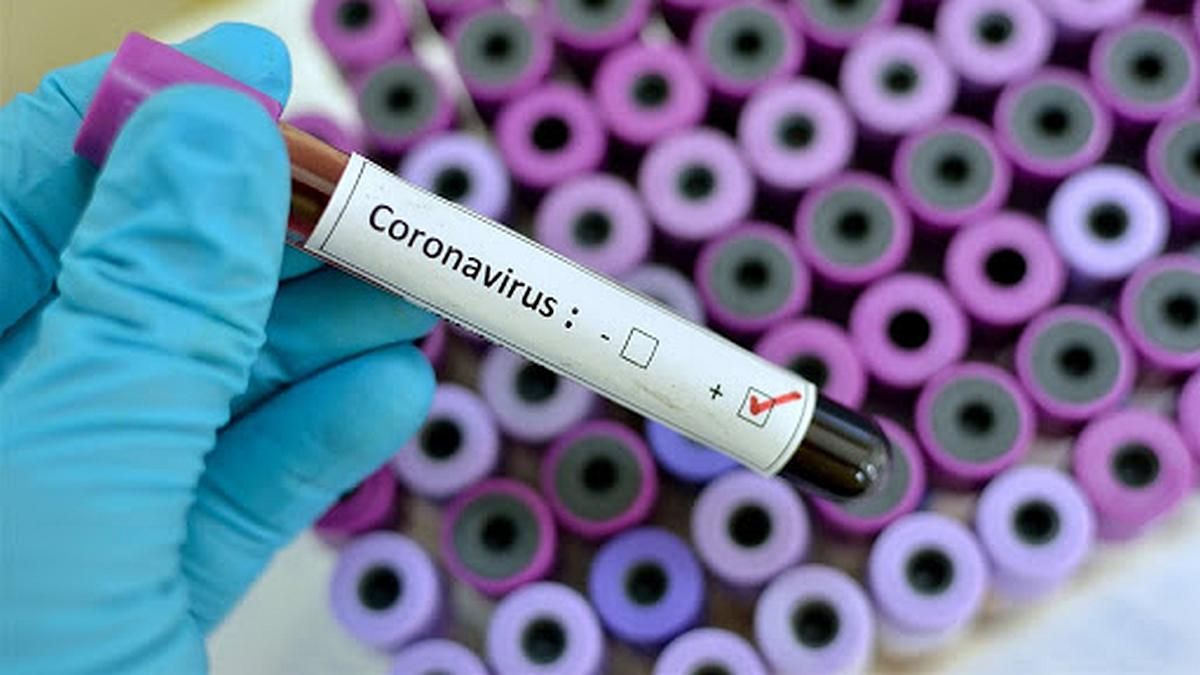 Coronavirus el segundo muerto en la Argentina es un ingeniero de