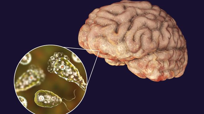 Ameba come-cerebros: qué es y cómo se contrae la infección.