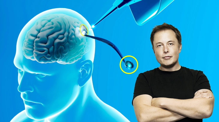 He also developed a surgical robot to carry out such implants efficiently. He also developed a surgical robot to carry out such implants efficiently.