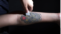 ¿Cómo sacarse tatuajes?