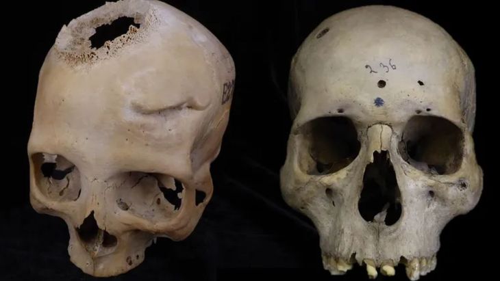 The skulls used in the study. The skulls used in the study.