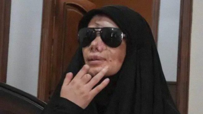 Nayfe tiene 29 años y era trabajadora de limpieza de un hospital, cuando un beeper le explotó en la cara.