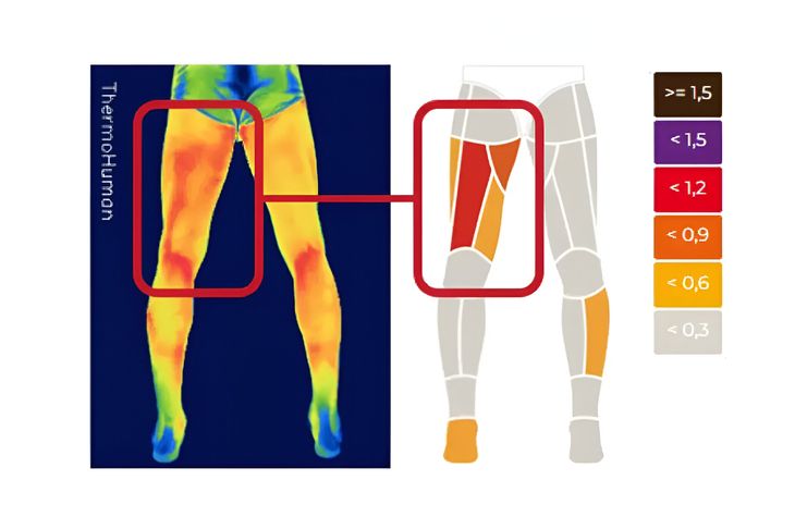 Themohuman uses thermal cameras and Ia. Themohuman uses thermal cameras and Ia.