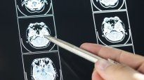 Investigadores de Cambridge destacaron cuatro edades cruciales para el cerebro.