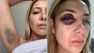 Las fotos de la violencia recibida por Fabiola Yañez.&nbsp;