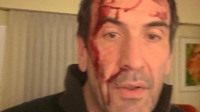 Cervi compartió esta foto tras el ataque en Neuquén.