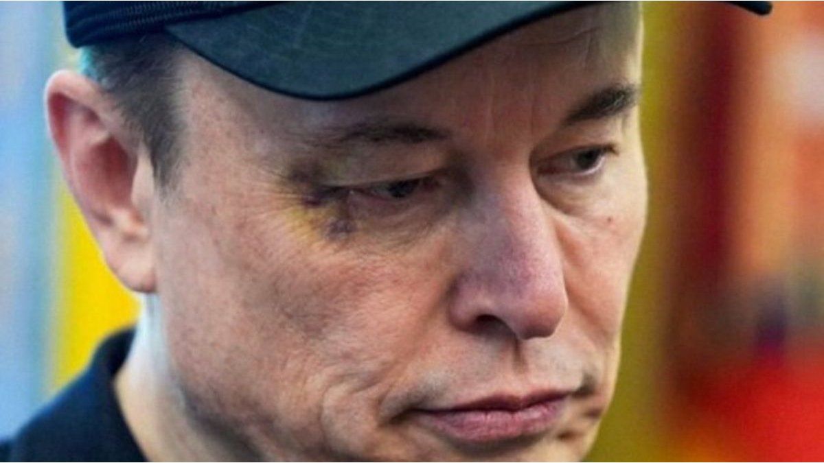 The unusual reason why Elon Musk appeared with a bruise on his face at a press conference with Donald Trump