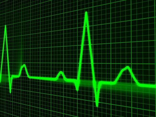 corazon electrocardiograma.jpg