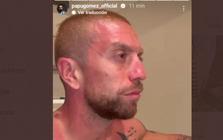 el papu gomez al rojo vivo: asi quedo el jugador argentino despues de la extensa caravana el papu gomez al rojo vivo: asi quedo el jugador argentino despues de la extensa caravana