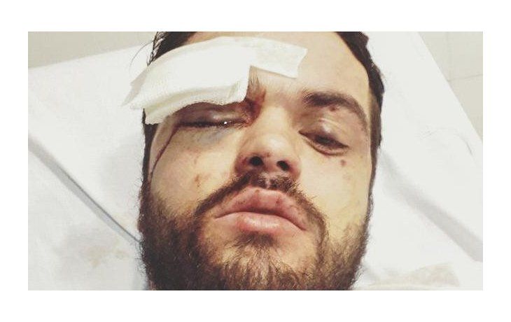 Brutal ataque homofóbico a un joven en Palermo