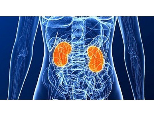 Salud. La insuficiencia renal aguda también puede precipitar otros cuadros, como la insuficiencia cardíaca sepsis y otro tipo de infecciones.