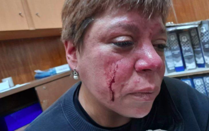 Agreden a golpes una inspectora municipal durante operativo de control por fiesta clandestina.
