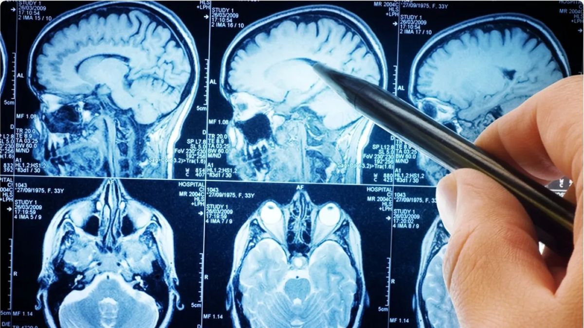 Nearly half of dementias can be prevented or delayed by controlling risk factors