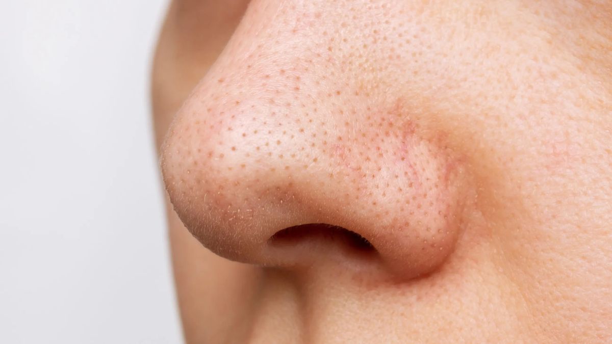 Neither black points nor dirt: what do you see in the pores of your nose