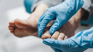 &nbsp;Cómo eliminar los hongos de los pies de manera definitiva con este método casero