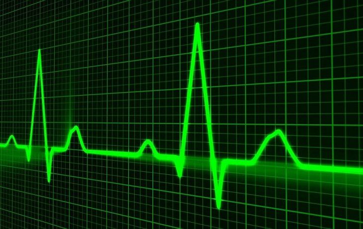 Fibrilación auricular: una de las enfermedades más comunes de Latinoamérica