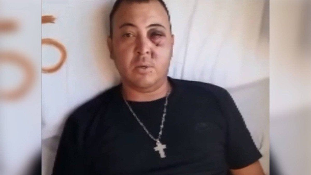 Hincha de Gimnasia podría perder un ojo por la represión policial: "Me arruinaron la vida"