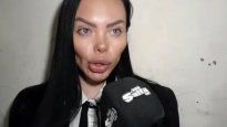 Laura Perea, la actriz salteña agredida por su ex
