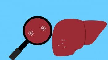 Hepatitis A.