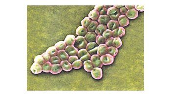 ámbito.com | La bacteria A.Baumannii vistaen un microscopioelectrónico.Ataca en Irak yAfganistán y hadesarrolladoresistencia atodos losmedicamentos.