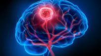Gracias a este estudio se facilitarán nuevos enfoques terapéuticos y podría ayudar a minimizar el daño al cerebro en desarrollo del niño.