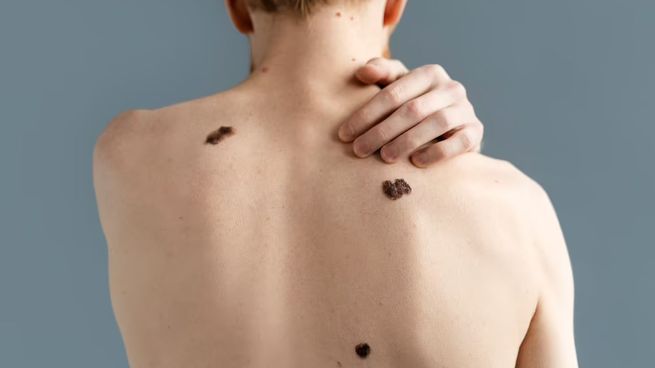 Entre las novedades en el mundo de estos tratamientos, surge la inmunoterapia.