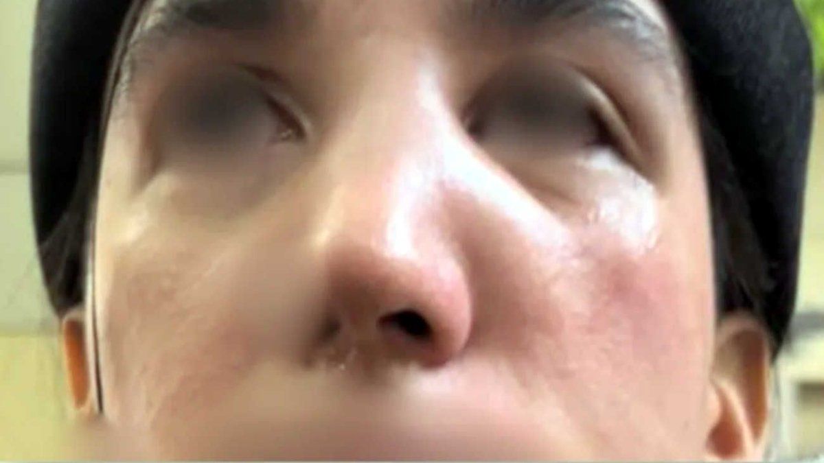 Violent attack against a couple of lesbians in Recoleta