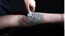 How to remove tattoos?