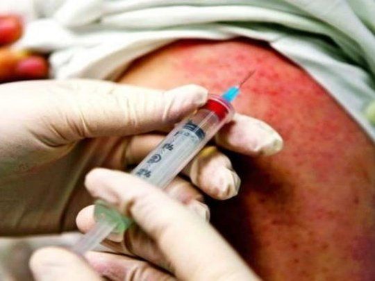 Hasta ahora hay 18 casos confirmados de sarampión en la Argentina.