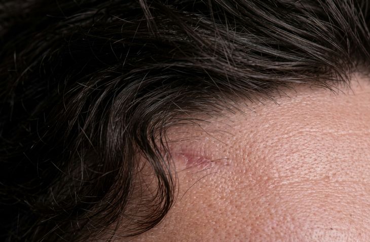 La marca en el rostro de Federico Valverde que se volvió viral en la previa del Mundial 2026 La marca en el rostro de Federico Valverde que se volvió viral en la previa del Mundial 2026