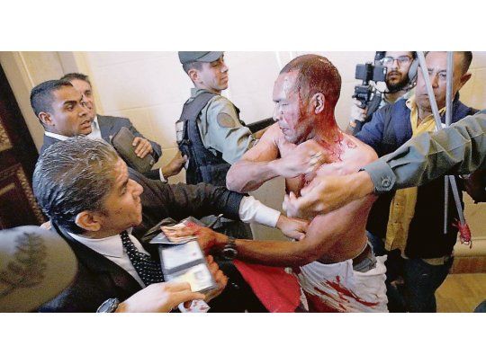 Día dramático en caracas. Diputados heridos, agresores desatados dentro del edificio del parlamento y un legislador que fue internado con pronóstico reservado. Postales de una Venezuela violenta que no encuentra el fondo de sus crisis.
