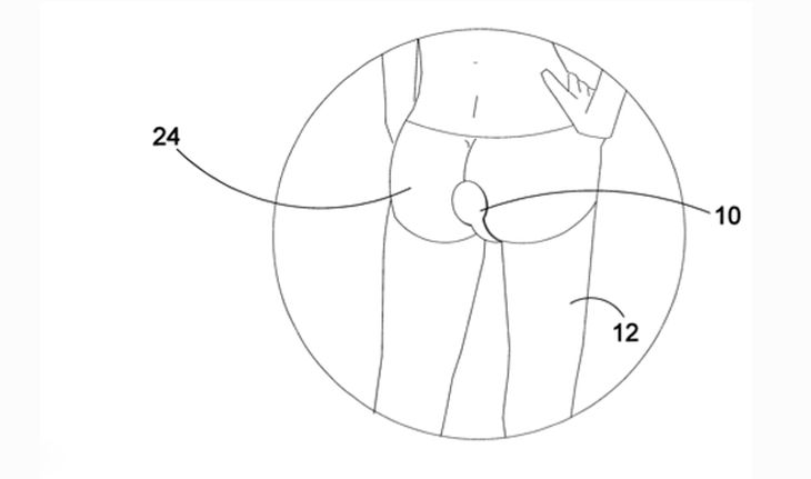 Millions of people suffer from gastric discomfort, so this invention would help them not feel embarrassed in moments they cannot contain.