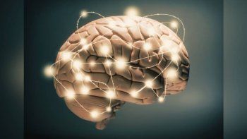 Cerebro.