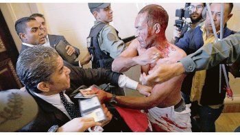 ámbito.com | Día dramático en caracas. Diputados heridos, agresores desatados dentro del edificio del parlamento y un legislador que fue internado con pronóstico reservado. Postales de una Venezuela violenta que no encuentra el fondo de sus crisis.