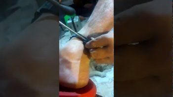 pablo bebote alvarez rompio su tobillera electronica y recupero su libertad