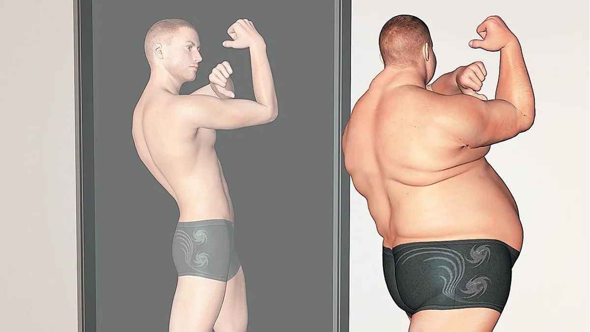 Día Mundial de la Obesidad: ¿qué es la megarexia?