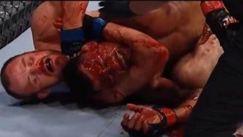 la sumision mas sangrienta de la ufc en 2018: le abrio la frente