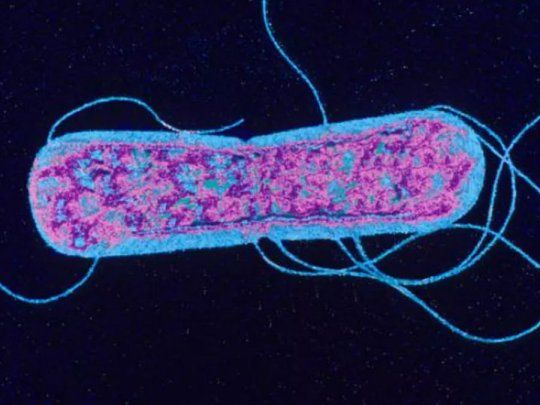 Salmonella.